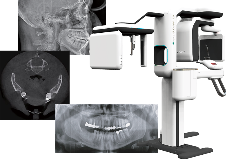 歯科用CT GC Aadva GX100 3D MX+1shotCephセファロ付き