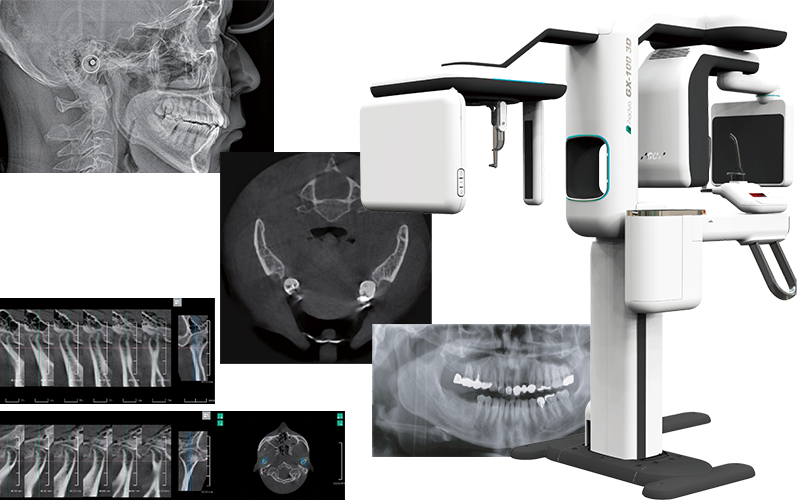 セファロ機能付き歯科用CT完備